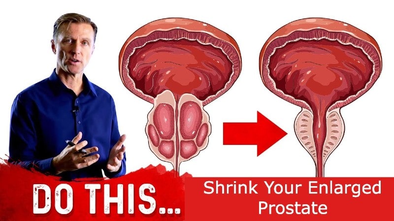 enlarged prostate treatment benign prostatic hyperplasia 