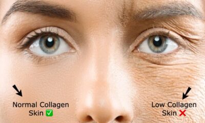 How to Increase Collagen Production Naturally Through Diet: The Top Foods and Tips