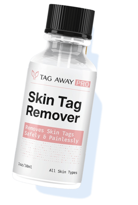 dr scholls freeze away skin tag remover reviews