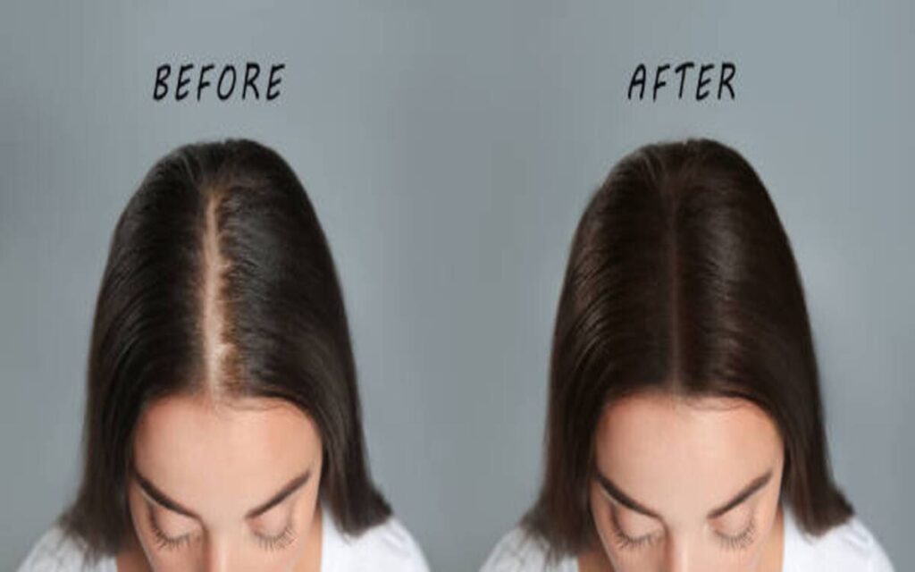 hair regrowth Testimonials and Results