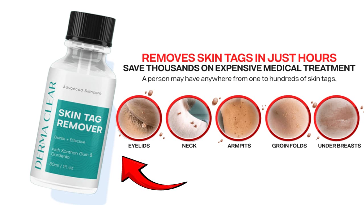 Derma Clear Skin Tag Remover before and after results