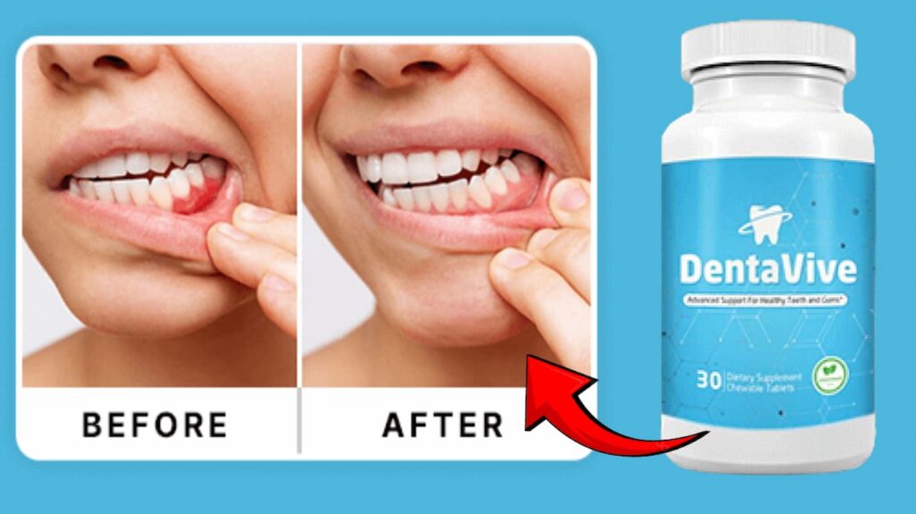 DentaVive Review: Does This Oral Probiotic Formula Really Work? 4 Vitamins For Healthy and Strong Teeth and Gums Dentavive