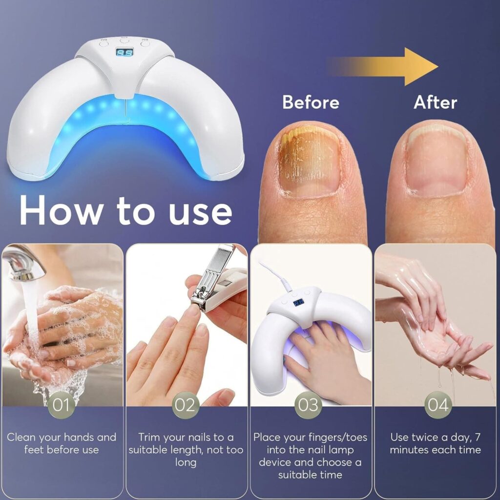 Fungabeam Review: Do Not Buy Till You've Read This! 3 What people want when they type “Fungabeam review”