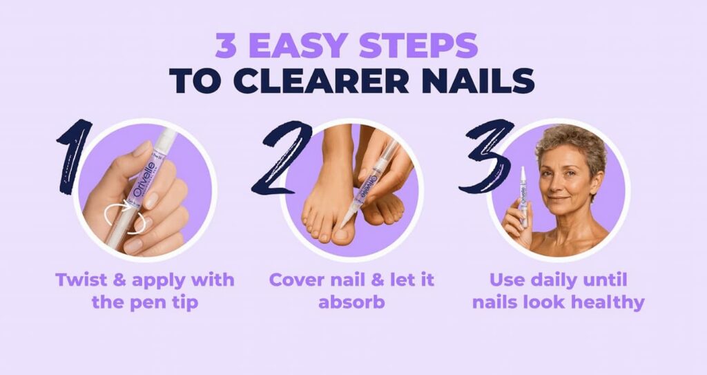 Oroville Nail Fungus Pen Review: Honest Results, Safety & Pricing 6 How to Use Oroville Nail Fungus Pen Correctly