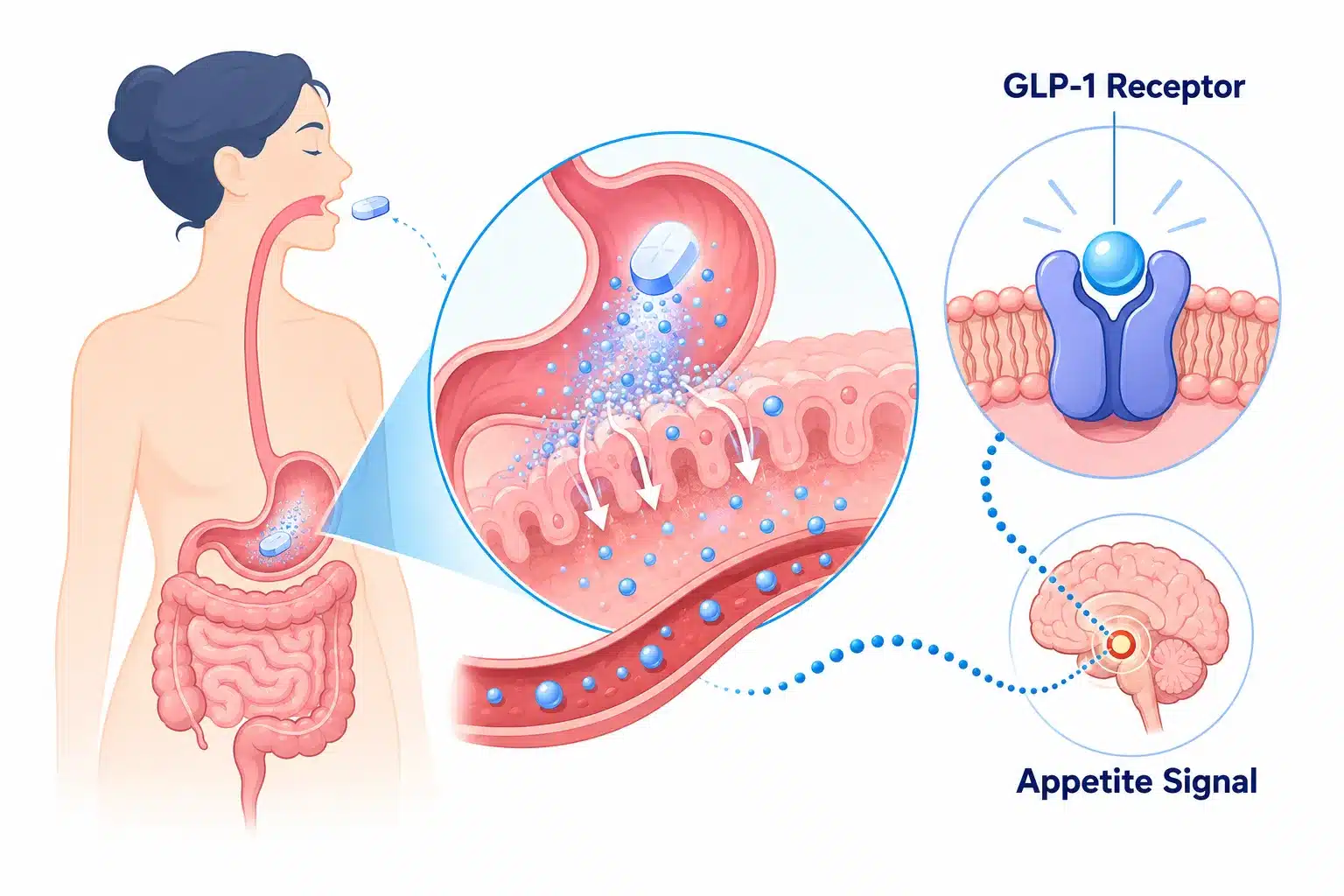Foundayo Rx Daily GLP-1 pill (orforglipron), no needle 2 What Is Orforglipron and How Does It Work