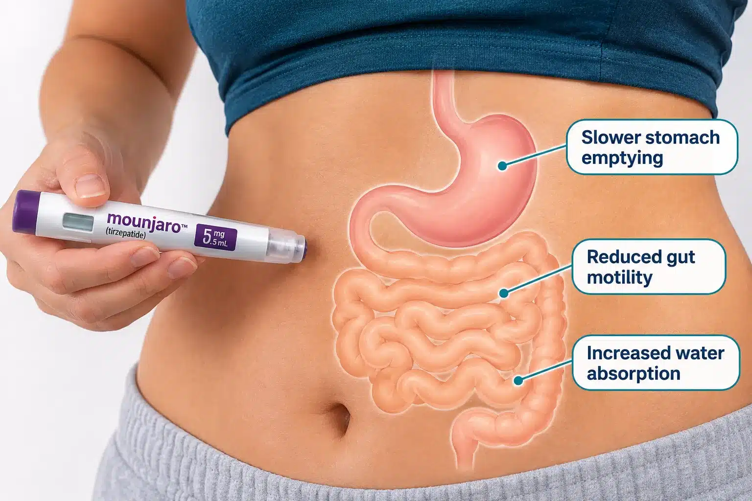 does mounjaro cause constipation 2 How Common Is Constipation With Mounjaro