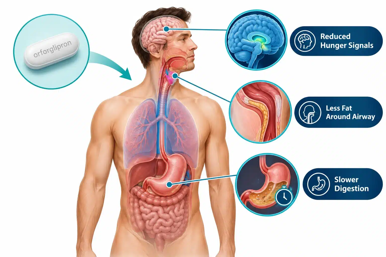 fondayo sleep apnea 3 How Does Fondayo Work for Sleep Apnea?