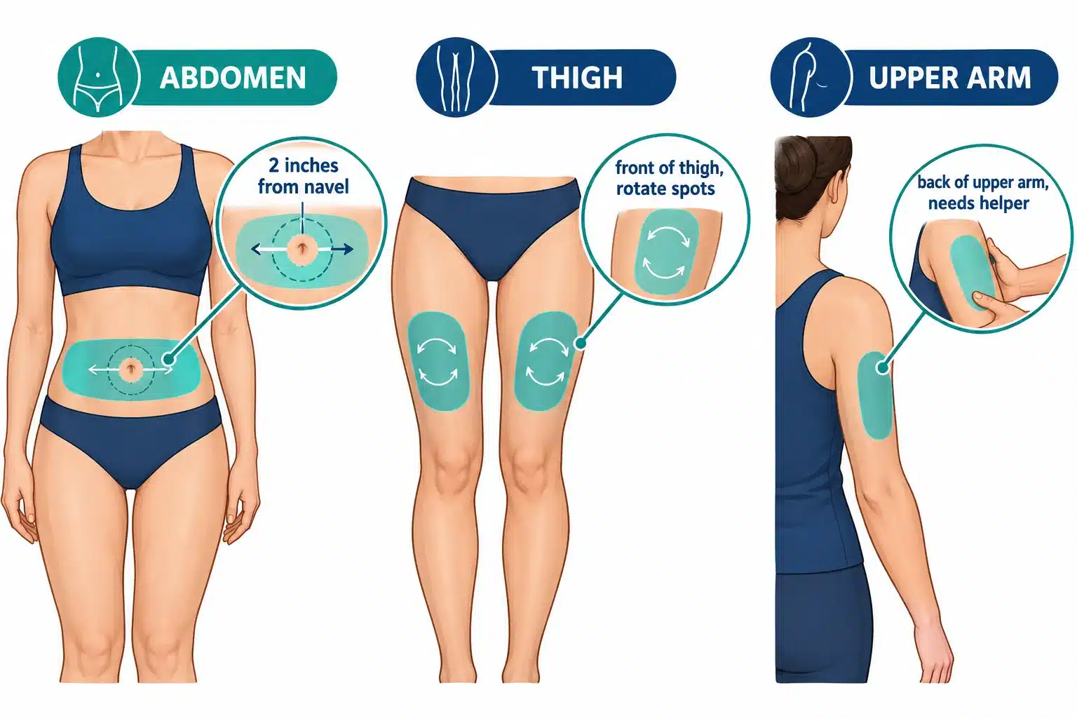 Where to Inject Ozempic: Best Sites & Step-by-Step Guide 2 What Are the Best Injection Sites for Ozempic