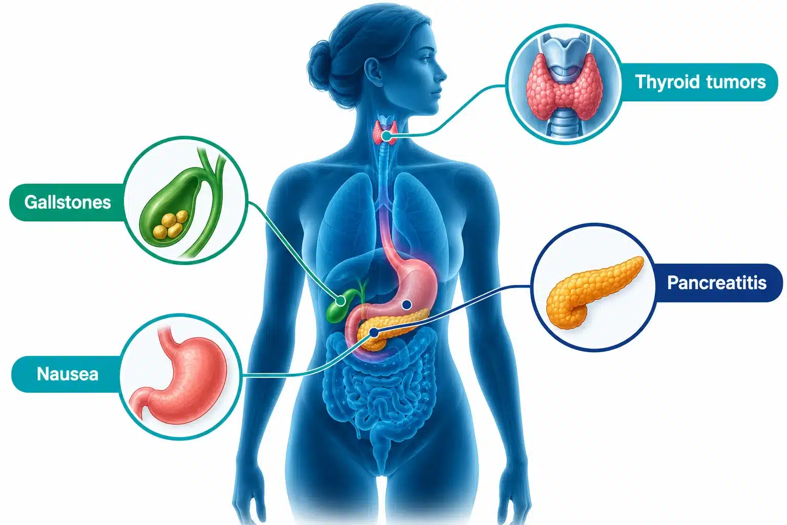 Wegovy Side Effects: Common, Serious & How to Manage Them 2 What Are the Most Common Side Effects of Wegovy