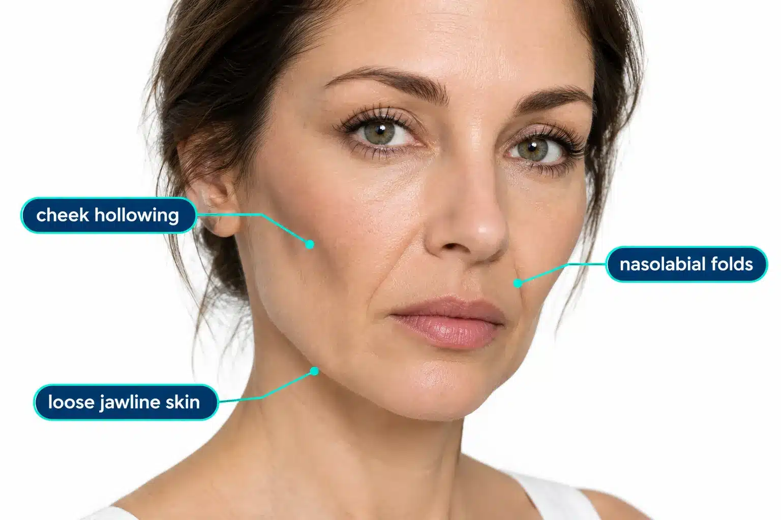 Ozempic Face: What It Is, Pictures & How to Prevent It 2 What causes Ozempic face and why does it happen
