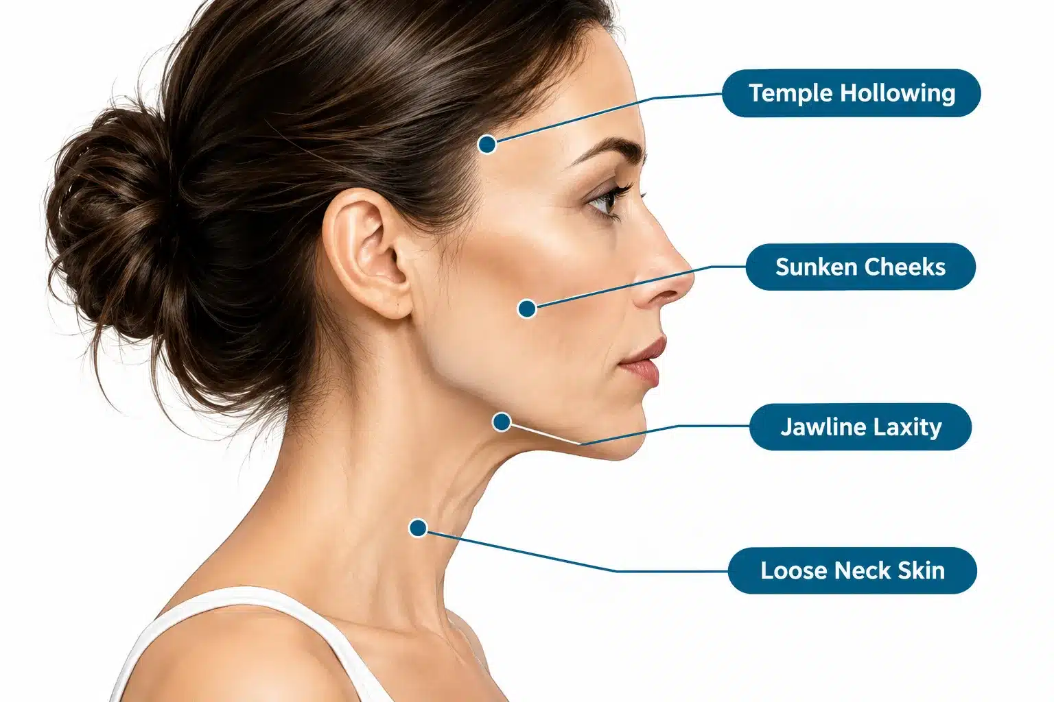 Dermal Fillers for Ozempic Face: Options, Cost & Results 2 What Exactly Is Ozempic Face and Why Does It Happen