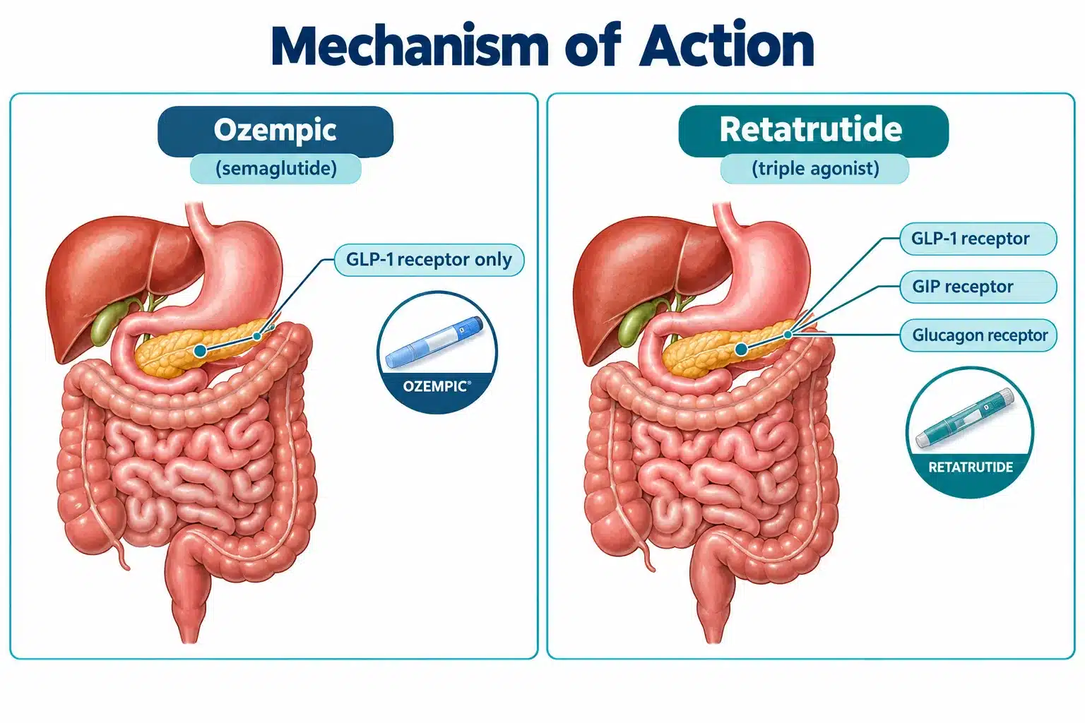 Retatrutide vs Ozempic: What the Trial Data Shows 2 What's the Main Difference Between Retatrutide and Ozempic